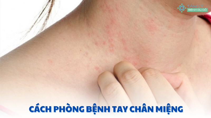 bệnh dị ứng thời tiết